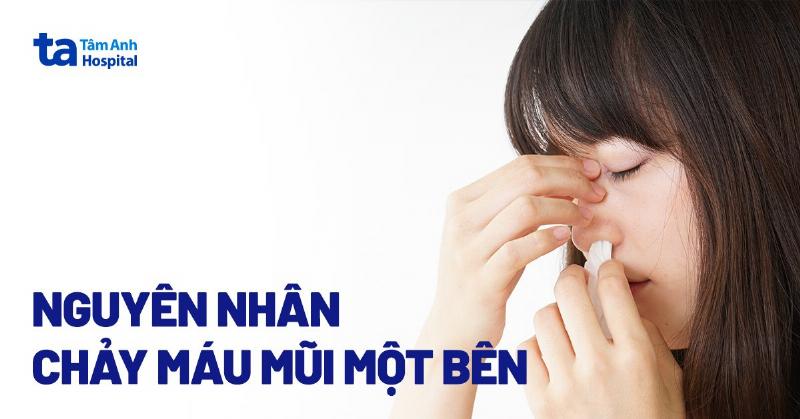 Mùng 1 Chảy Máu Cam: Nguyên Nhân Và Cách Xử Lý