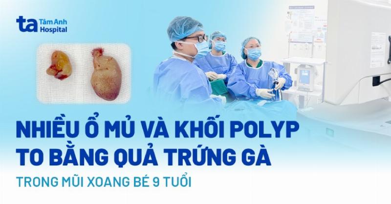 Trứng Gà Và Tâm Lý