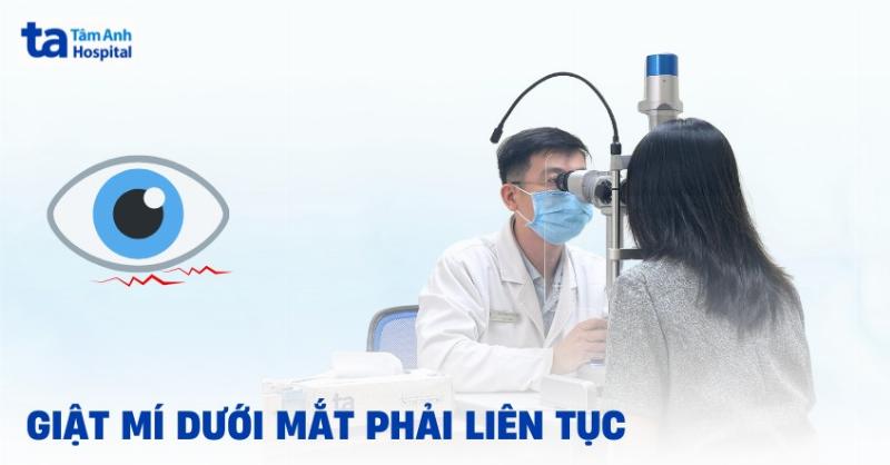 Mẹo hay chấm dứt giật mắt trái ở nữ