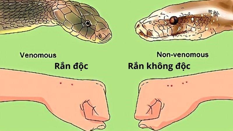 Mơ thấy rắn độc cắn: Đánh giá lại sức khỏe của bạn