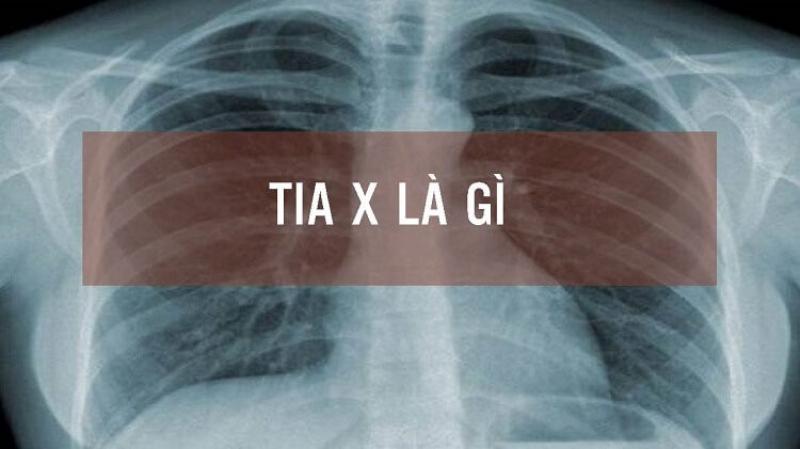 Ứng dụng của tia X trong công nghiệp