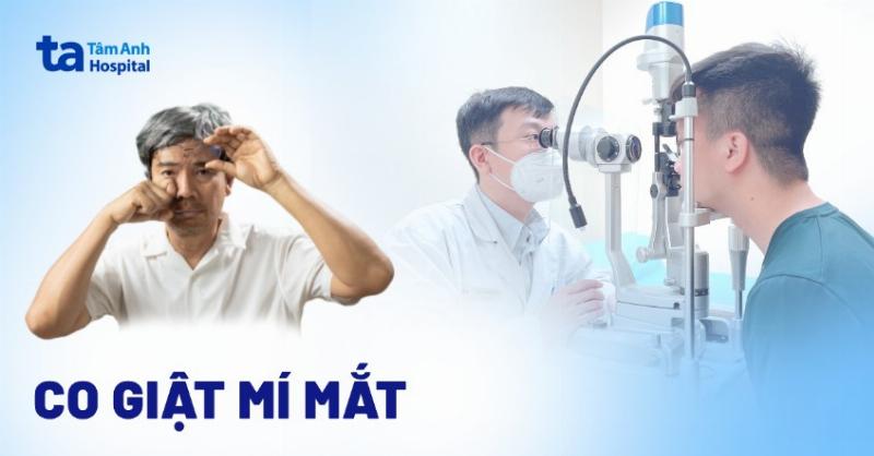 Hình ảnh minh họa các nguyên nhân khoa học phổ biến gây hiện tượng mắt phải bị giật như căng thẳng, mệt mỏi, mỏi mắt