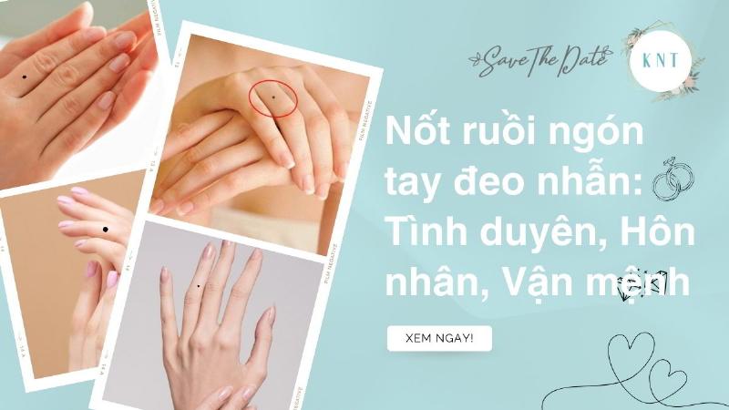 Minh hoa su khac biet y nghia not ruoi o ngon tay giua tay trai va tay phai