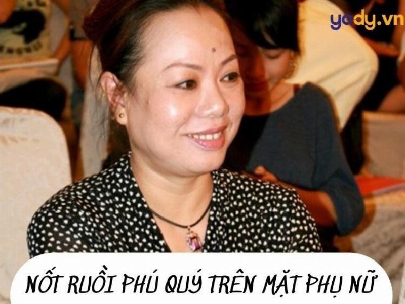 Nốt ruồi giữa trán trên gương mặt, ý nghĩa tướng số về vận mệnh và tài lộc