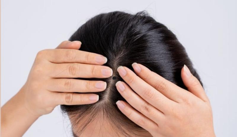 Ý nghĩa phong thủy và nhân tướng học của nốt ruồi giữa trán, vận mệnh cuộc đời