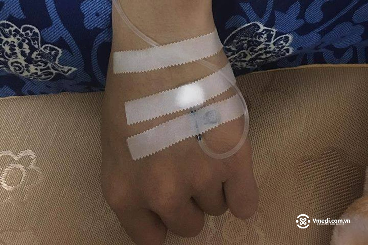 Ảnh truyền nước ở tay nam giới trẻ tuổi (con trai)