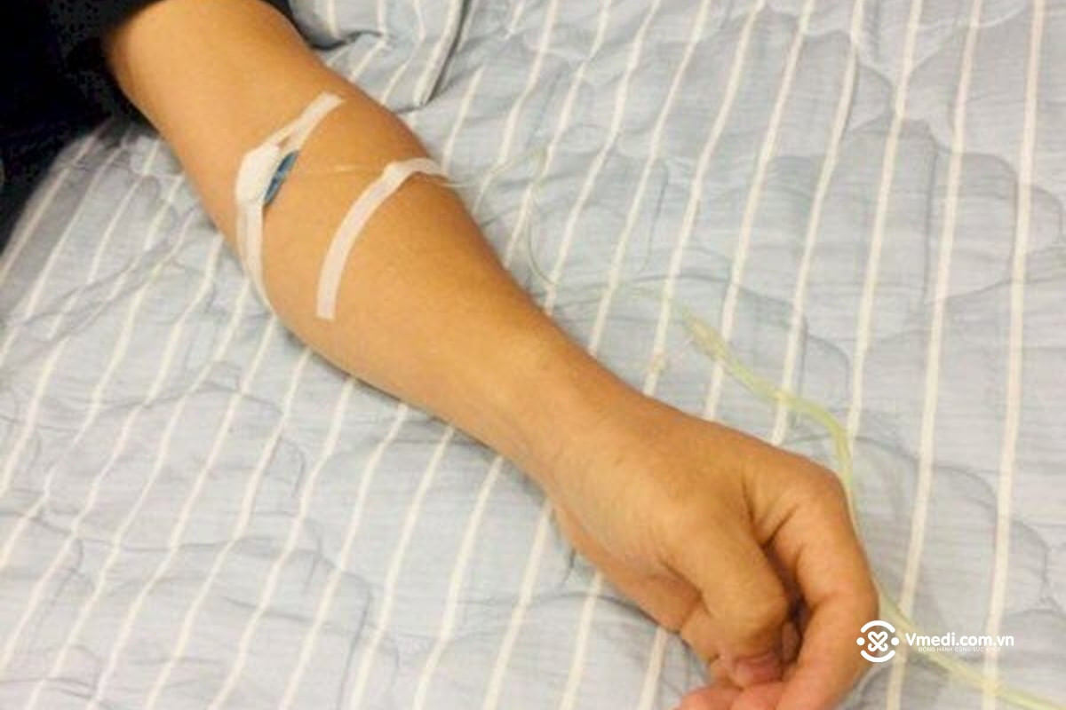 Ảnh truyền nước ở tay nam giới (con trai) tại nhà