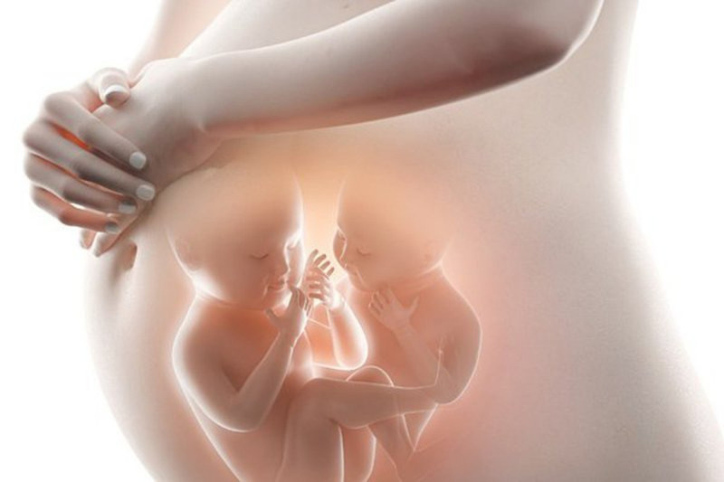 Hình ảnh bà bầu mang thai đôi, minh họa nguyên nhân dư ối thường gặp