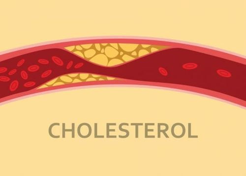 Mức cholesterol cao hoặc dung nạp quá nhiều cholesterol từ thực phẩm có thể ảnh hưởng sức khỏe