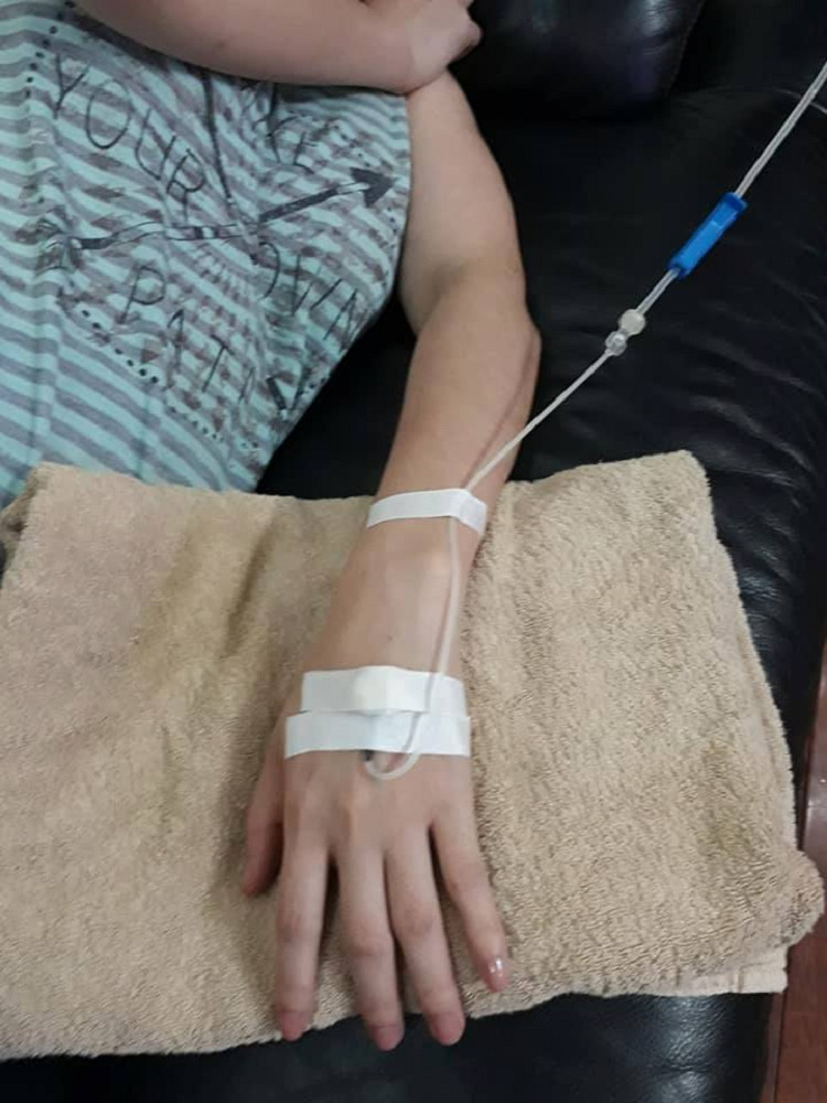 Hình ảnh một túi dịch truyền đang chảy vào tĩnh mạch ở tay, cho thấy quá trình điều trị.