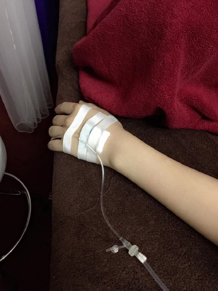 Cận cảnh kim truyền và băng dính cố định trên mu bàn tay bệnh nhân.