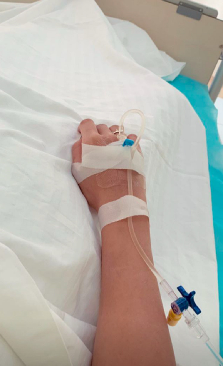 Một góc chụp khác về bàn tay đang truyền nước biển, với băng keo y tế.