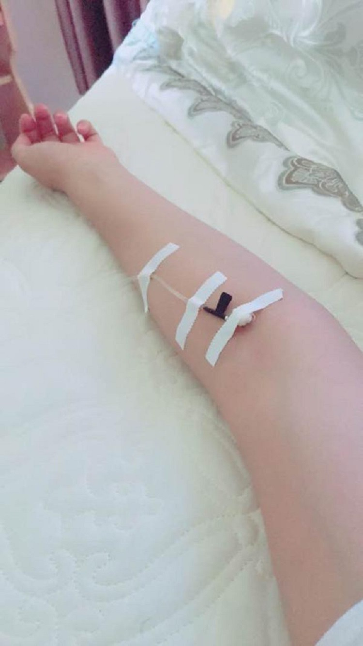 Ảnh chụp tay một cô gái trẻ đang truyền nước biển, thể hiện quá trình điều trị tại bệnh viện.