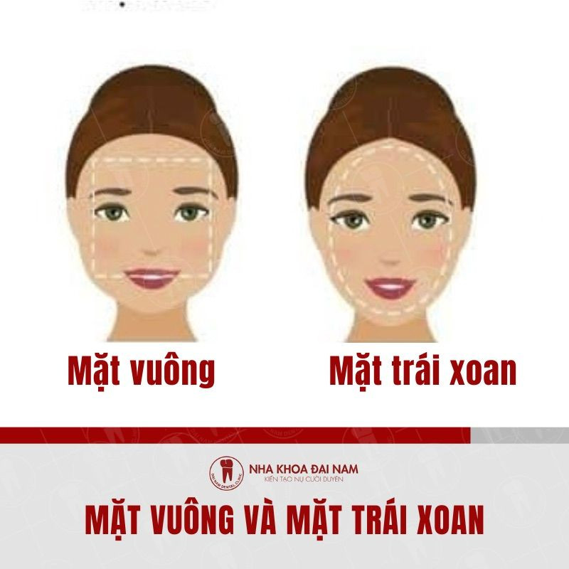Sự khác biệt giữa mặt vuông và mặt trái xoan