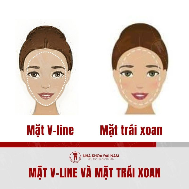 So sánh mặt V-line và mặt trái xoan