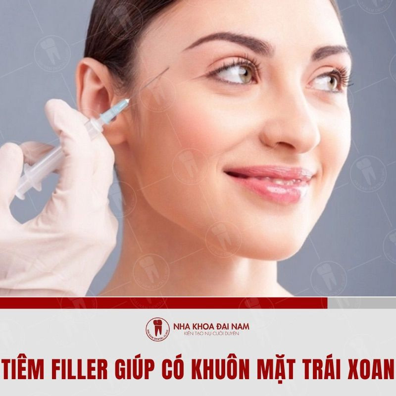 Tiêm filler giúp tạo hình khuôn mặt trái xoan